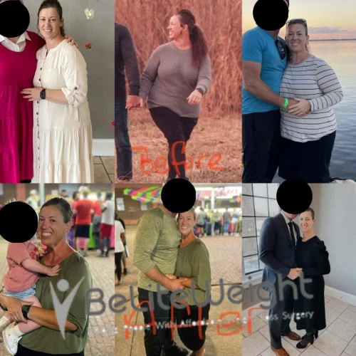 Weight Loss Surgery Gastric Sleeve before and after Brandy B - 1 Year Update*
